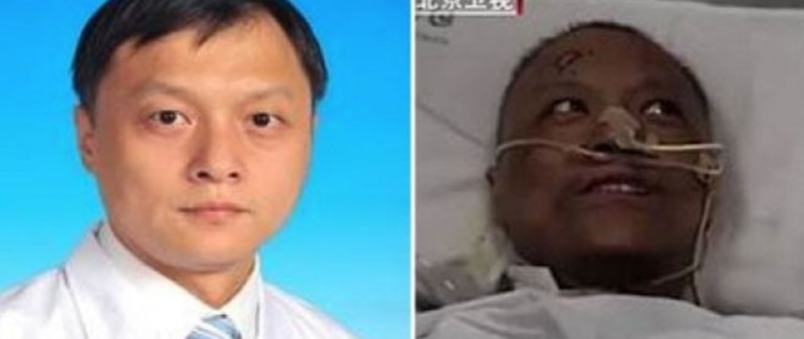 Qué sabemos sobre los dos médicos chinos cuya piel supuestamente ...