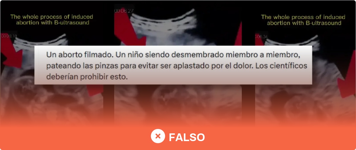 No, este vídeo no es un aborto real: es una escena de la película ‘Unplanned’