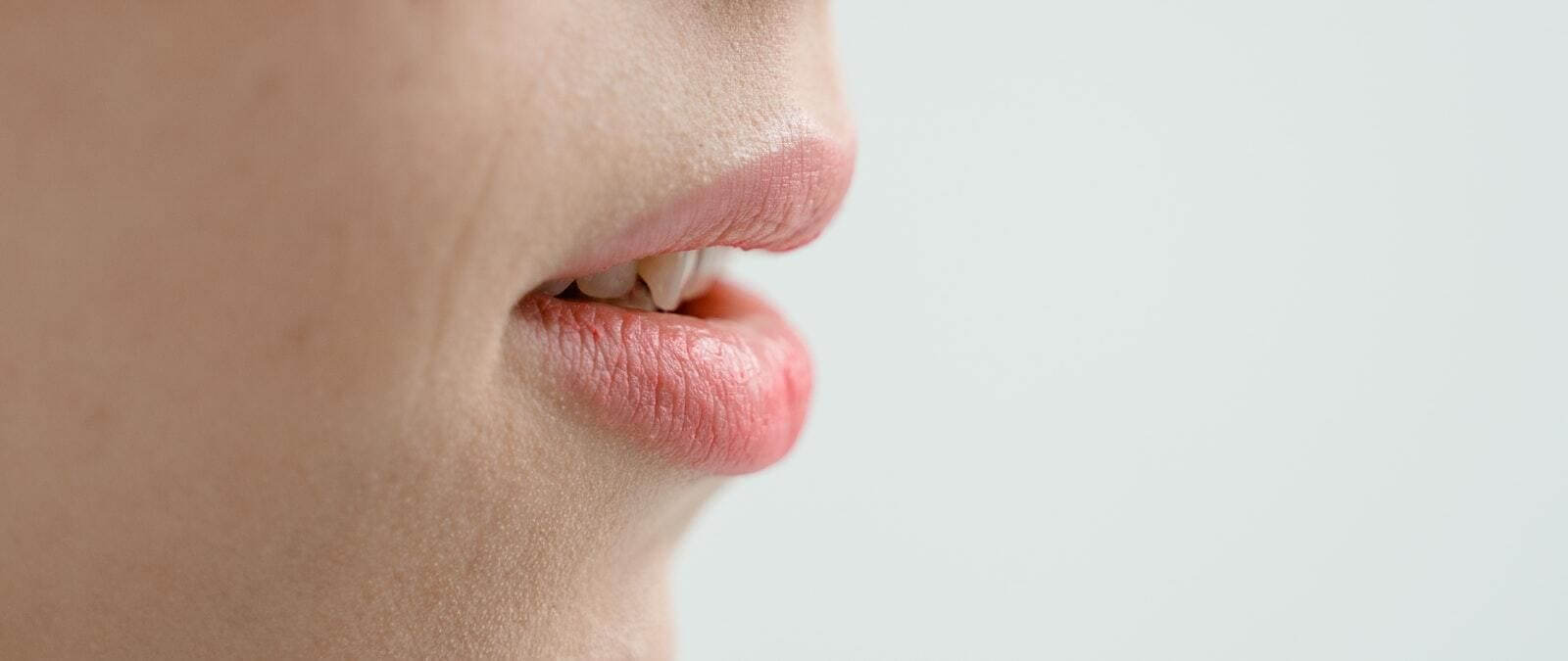 Lo que debería saber sobre el herpes labial